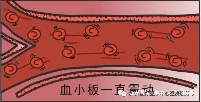 【科普】血小板是正常值的三倍？專家提醒小心血栓和出血！