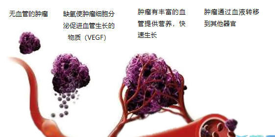 晚期腫瘤為什么會(huì)復(fù)發(fā)轉(zhuǎn)移？