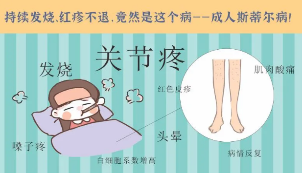 持續(xù)發(fā)燒、紅疹不退……她終于在這里治好了這個(gè)罕見病