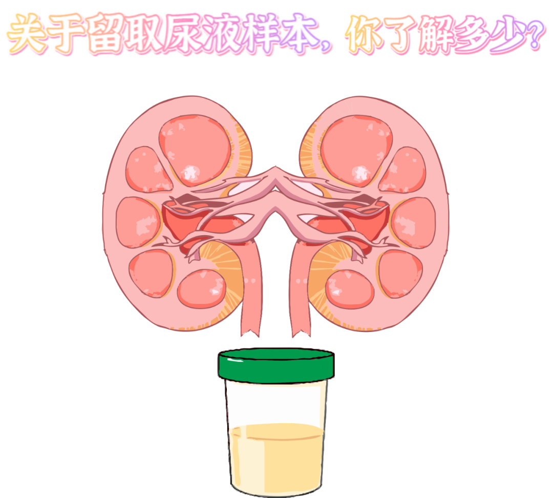 做尿檢，不得不說的注意事項(xiàng)！