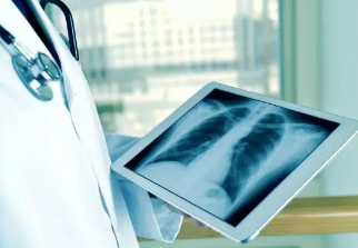 健康呼吸④體檢發(fā)現(xiàn)肺結(jié)節(jié)，我該怎么辦？