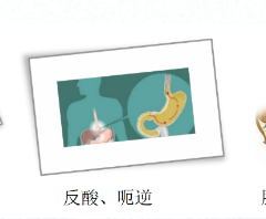 關(guān)愛身體健康，輕松檢查胃腸