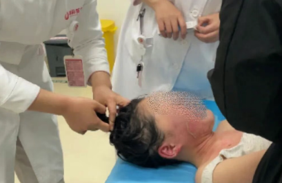 14歲，面、頸、胸燙傷，只因中午那鍋面湯…